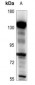 Anti-BARD1 Antibody