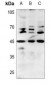 Anti-BMP8B Antibody