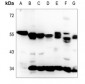 Anti-Calreticulin Antibody