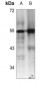 Anti-RUNX1 Antibody