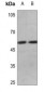Anti-Cyclin E1 (pT395) Antibody