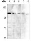 Anti-LI Cadherin Antibody