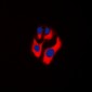 Anti-CKMT2 Antibody