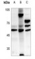 Anti-CKMT2 Antibody