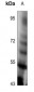 Anti-TPL2 (pT290) Antibody