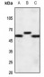 Anti-CRHR1 Antibody