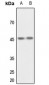 Anti-CSK Antibody