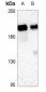 Anti-CD143 Antibody