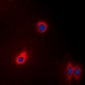 Anti-EEF2 Antibody