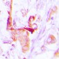 Anti-EEF2 Antibody