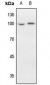 Anti-EEF2 Antibody