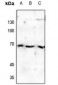 Anti-Estrogen Receptor alpha (pS118) Antibody