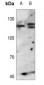 Anti-FGFR1 Antibody