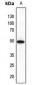 Anti-FNTB Antibody