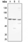 Anti-GCKR Antibody