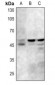 Anti-GSK3 alpha/beta (pY279/216) Antibody