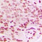 Anti-Histone H1.0 Antibody