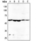 Anti-HARS Antibody