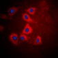 Anti-HEXB Antibody