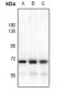 Anti-HEXB Antibody