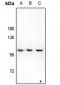 Anti-Hexokinase 3 Antibody