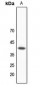 Anti-hNRNP C Antibody