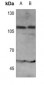 Anti-IFNAR1 (pY466) Antibody