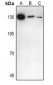 Anti-IL-16 Antibody