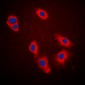 Anti-Cytokeratin 18 (pS33) Antibody