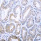 Anti-Cytokeratin 18 (pS33) Antibody