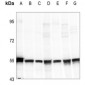 Anti-Cytokeratin 18 (pS33) Antibody