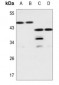 Anti-Galectin 8 Antibody