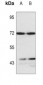 Anti-LIMK1/2 Antibody