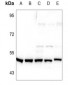 Anti-TAU (pS713) Antibody