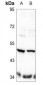 Anti-TAU (pT498) Antibody