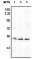 Anti-MEF2A (pT319) Antibody