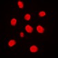 Anti-MEKK3 Antibody