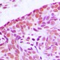 Anti-MEKK3 Antibody