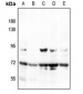 Anti-MEKK3 Antibody