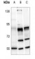 Anti-MMP16 Antibody