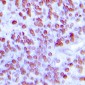 Anti-MNDA Antibody