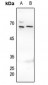 Anti-MUTYH Antibody