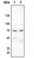 Anti-Merlin (pS518) Antibody