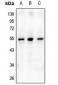 Anti-Osteoprotegerin Antibody