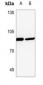 Anti-PLA2G4A Antibody