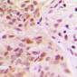 Anti-Rpb1 CTD (pS1619) Antibody
