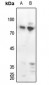 Anti-PKC delta (pY313) Antibody