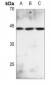Anti-MKK2 (pT394) Antibody