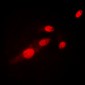 Anti-NF-kappaB p65 (AcK310) Antibody