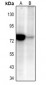 Anti-NF-kappaB p65 (AcK310) Antibody